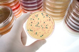 Antibiotic Resistant “Superbug” CRE
