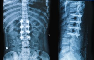 back x ray