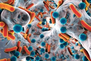 Superbugs