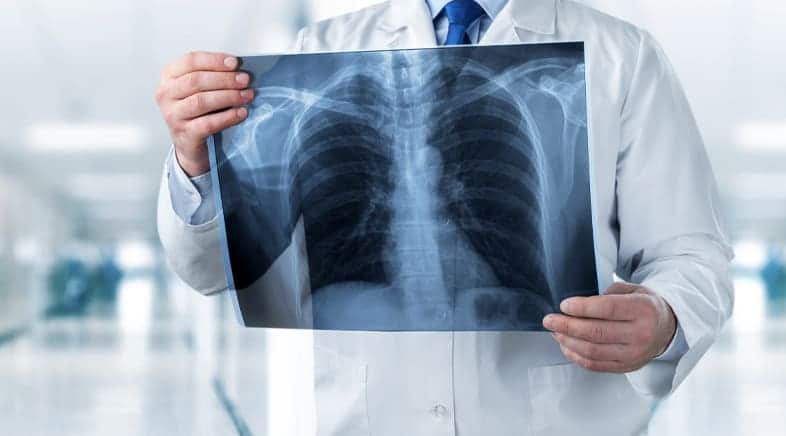 Spinal Cord Injury Lawyer Maryland