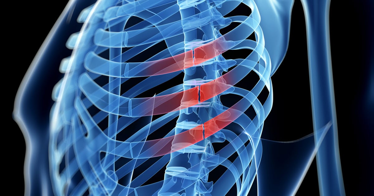 Injuries to the Chest from Vehicle Crashes Car Accident Maryland