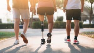What Complications Can Arise from Amputations?