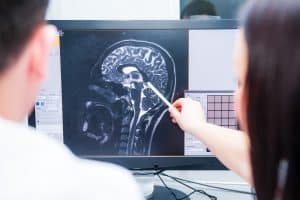 Brain Stem injuries